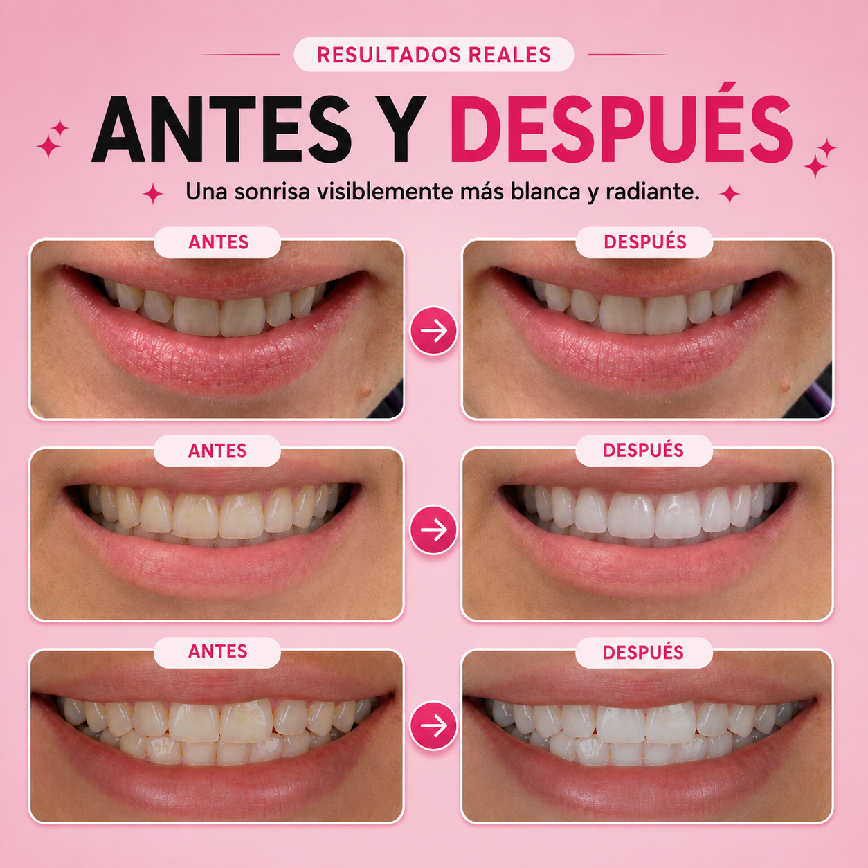 Recupera la sonrisa que evitas mostrar en fotos!