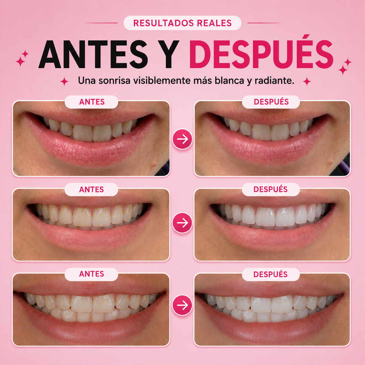 Recupera la sonrisa que evitas mostrar en fotos!