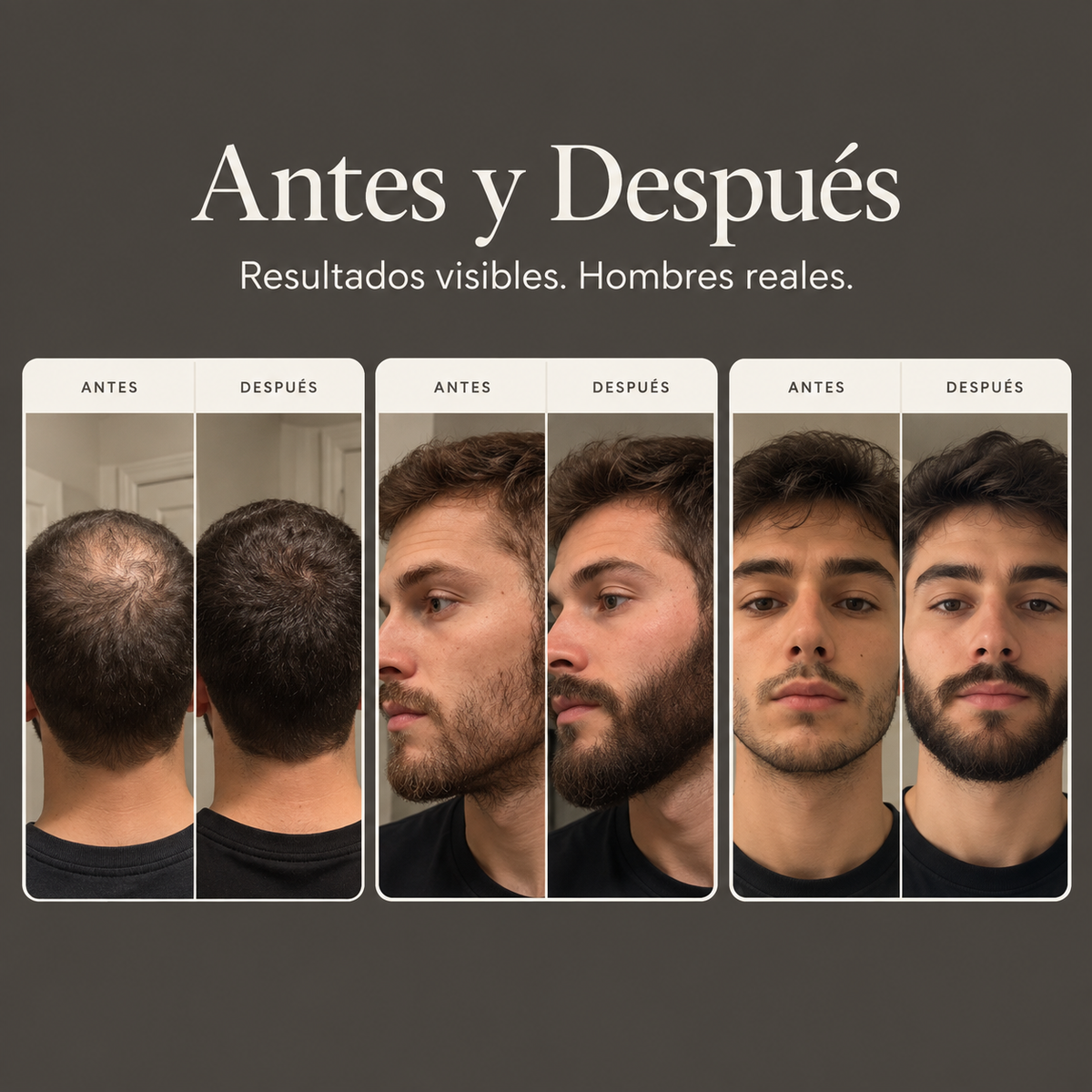 VYNE — Sérum de Densidad Visible para Hombres